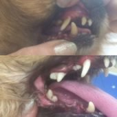 чистка зубов ультразвуком без наркоза (до и после процедуры)